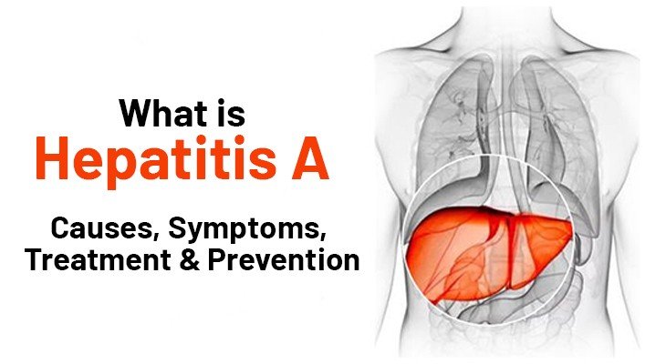 Hepatitis-A