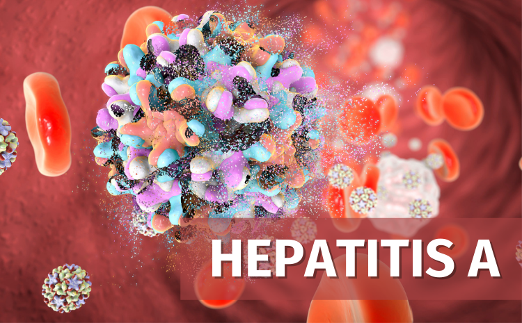 Hepatitis-A