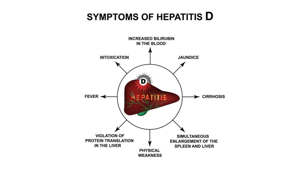 Hepatitis-D