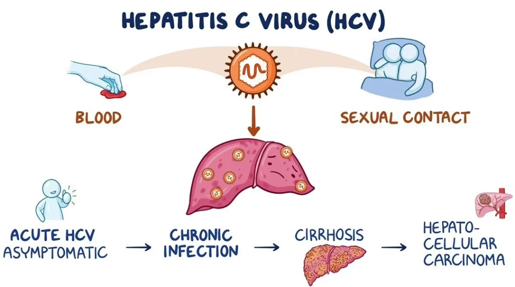 hepatitis-c