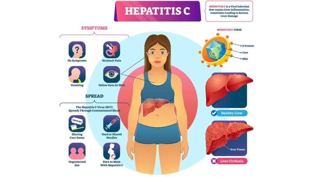 hepatitis about